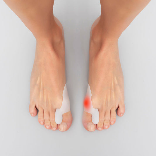 Vaivaisenluun suoja silikoninen korjain 2 kpl - unisex one-size antibakteerinen